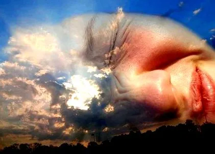 neuralgia neuralgia