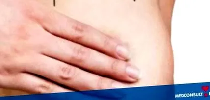 műtét után műtét után