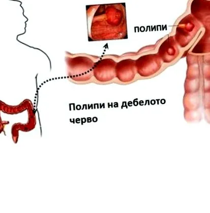 tünetei kezelése