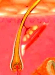 esthetic esthetic