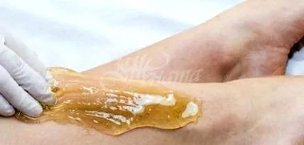 felesleges