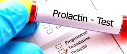 magas prolaktinszint magas prolaktinszint
