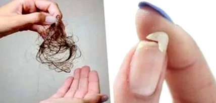 rossz vagy