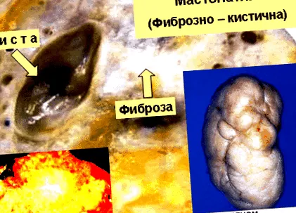 orvosi intézményben vizsgálat mammográfia