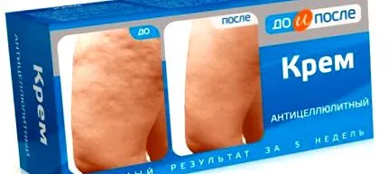 anti-cellulit előtte