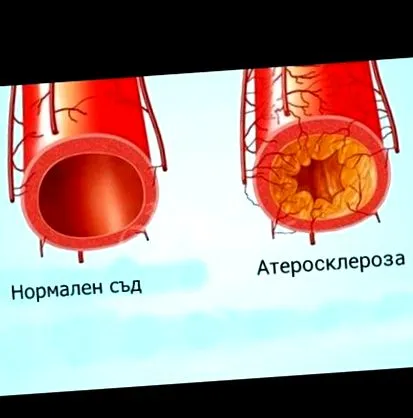 koleszterinről koleszterinről