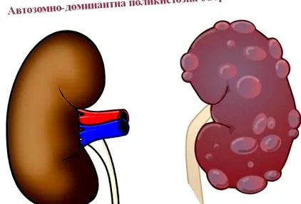domináns diagnosztizálása