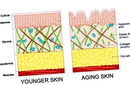 hialuronsav biorevitalizáció