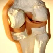 osteoarthritisének