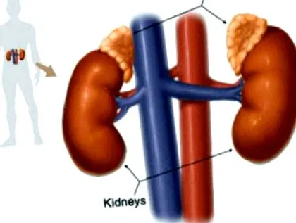 adenoma