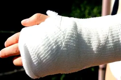 osteogenesis törékeny