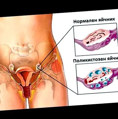 nőgyógyászok