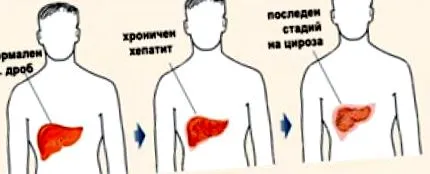 jobb hypochondriumban májproblémák