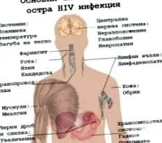 fertőzés szakasza immunhiányos szindróma