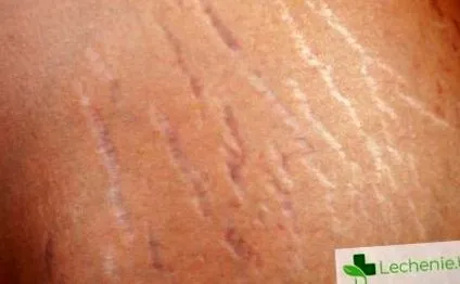 háttér hormonális