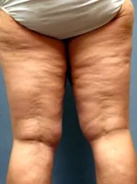 krém