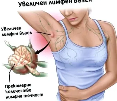 megnagyobbodott tünet