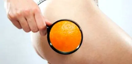 narancsbőrt recept