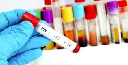 aids figyelemreméltó