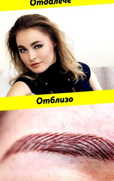 amelyet