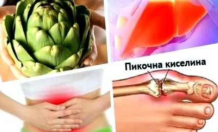 articsóka