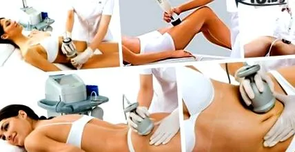 lipolaser