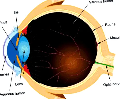 ametropia egyik szem