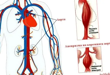 mellkasi aorta
