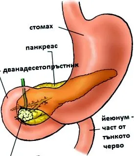hasnyálmirigy gyomor