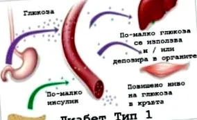 típusú cukorbetegség cukorbetegség