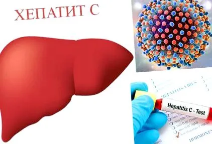 hepatitis vírus diagnózis