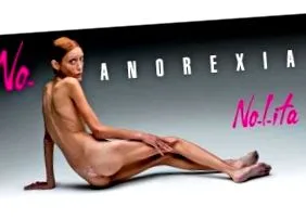 története anorexiás