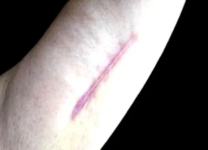 hogyan