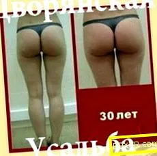 ábra