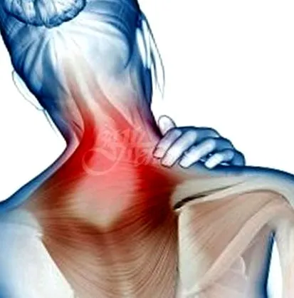 fibromyalgia