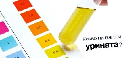 ketonszint ketonszint