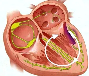 tachycardia szívdobogásérzés