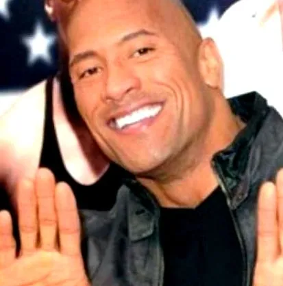 kopasz nézze