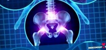 rheumatoid arthritis
