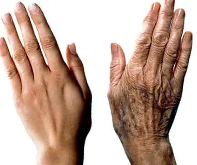 aging aging