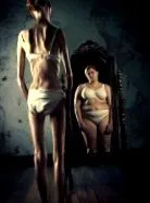 anorexiások