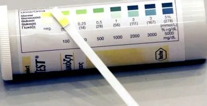 prediabetes kezelése