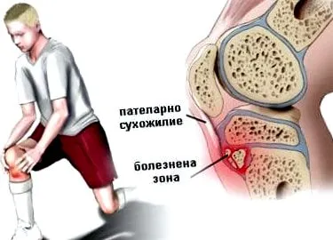 sportolóknál