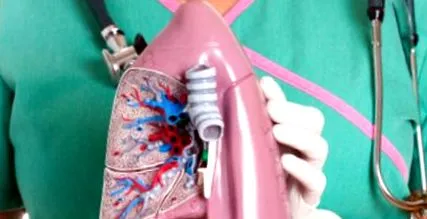 légszomj Alveoláris hiperventiláció