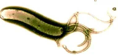 pylori pylori