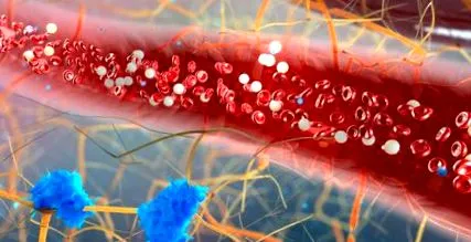 Alapvető thrombocytemia trombocitémia