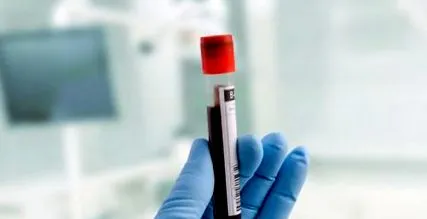 alapvető thrombocytemia