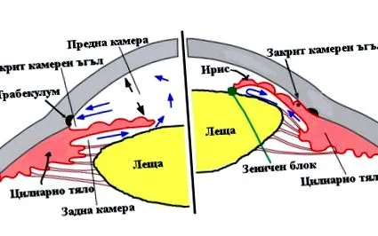 provokáló