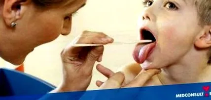 gyakran köhög pharyngitis