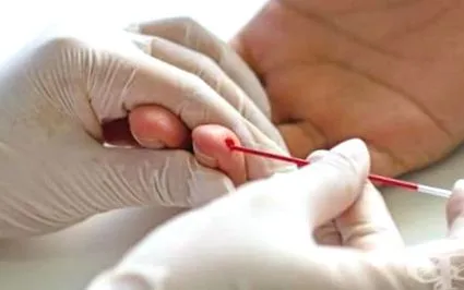 hematokrit értékek általában teljes